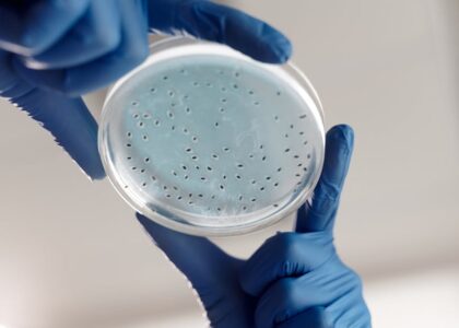 Close-up of gloved hands holding a petri dish with bacterial cultures in a lab.
